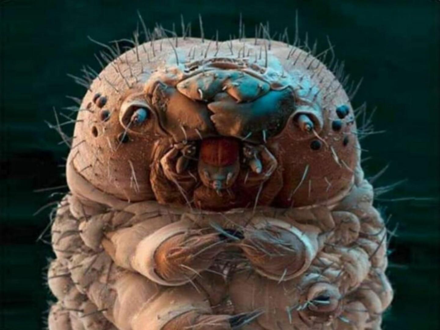 Demodex 